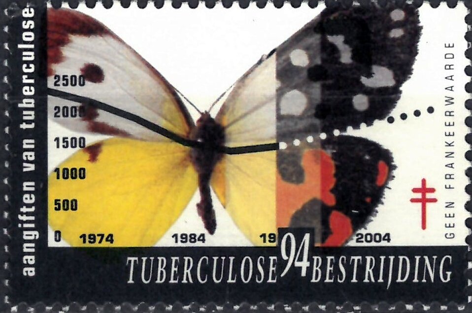 Tuberculosis