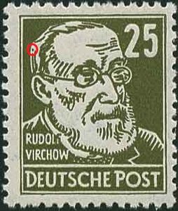 Virchow
