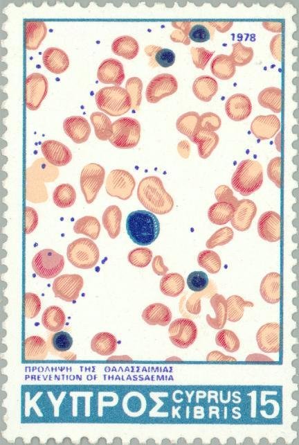 Prevention of Thalassaemia