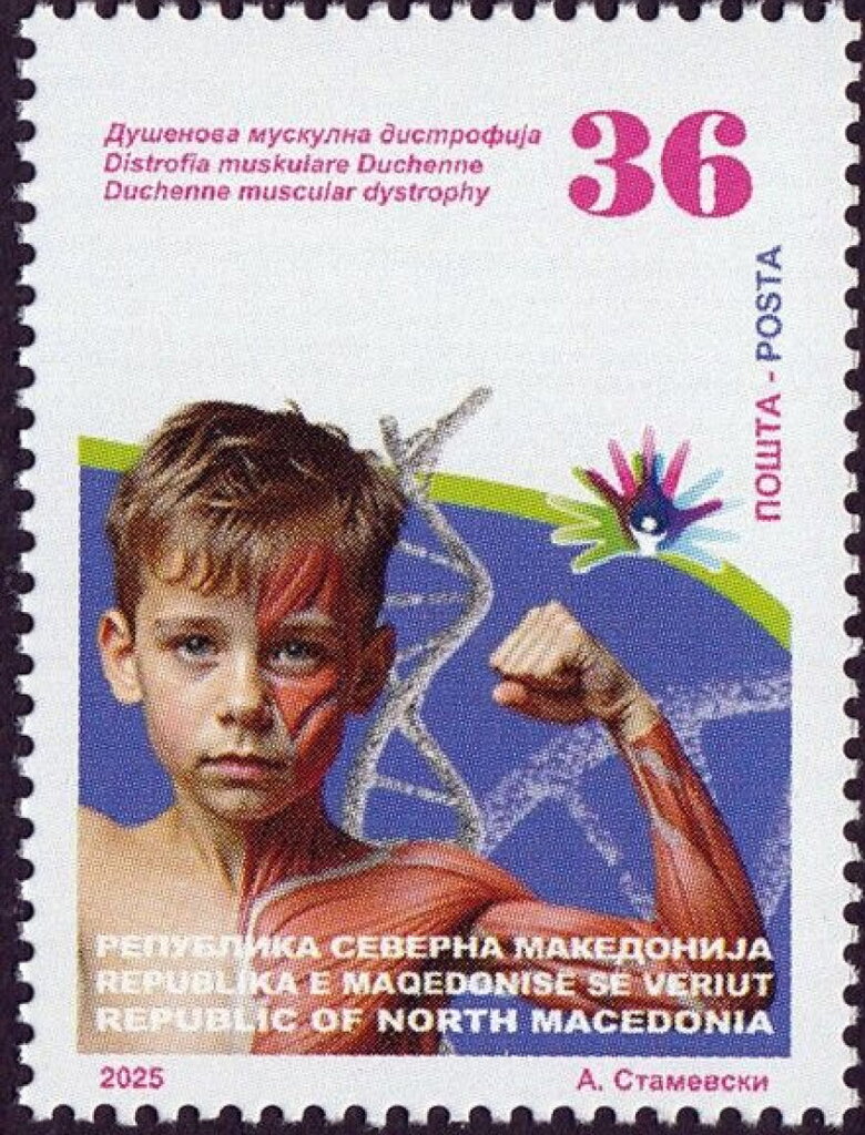 Children's Diseases : Duchenne Muscular Dystrophy