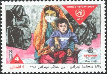 World TB Day 2004