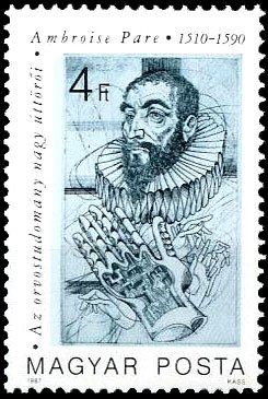 Ambroise Pare