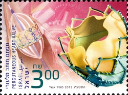 Israeli Achievements - Cardiology Percutaneous Heart Valve
