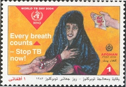 World TB Day 2004