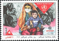 World TB Day 2004