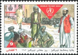 World TB Day 2004