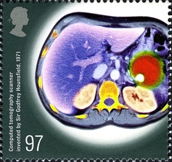 Medical Breakthroughs - Computed tomography scanner invented by Sir Godfrey Hounsfield 1971