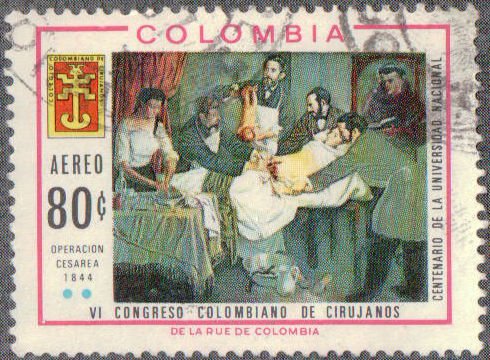 First cesarean operation in Latin America