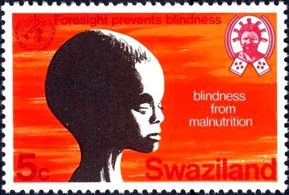 Blindness from malnutrition