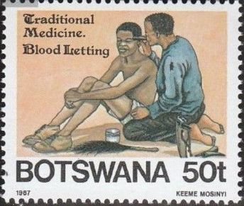 Bloodletting