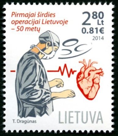 2014 The 50th Anniversary of the First Open Heart Surgery at