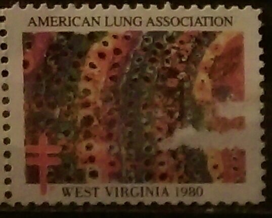 American Lung Association. West Virginia