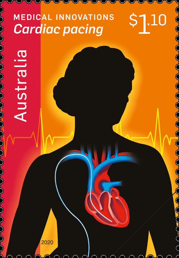 Cardiac Pacing